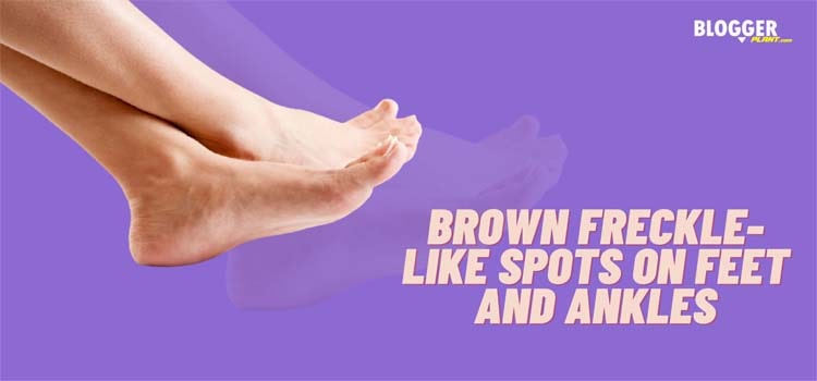 What causes brown spots on feet and lower legs?